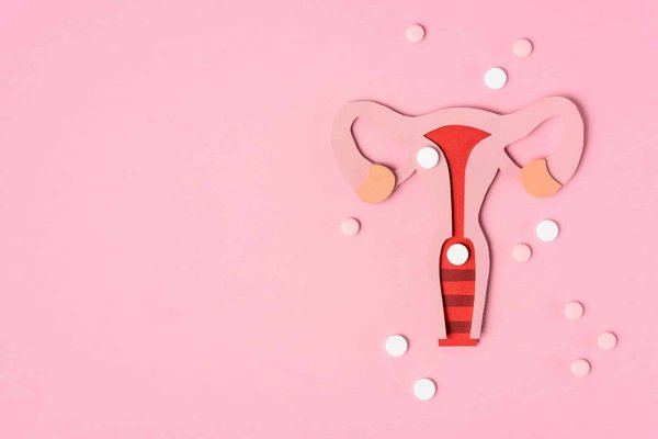 Comment reproduire une pièce plastique ?